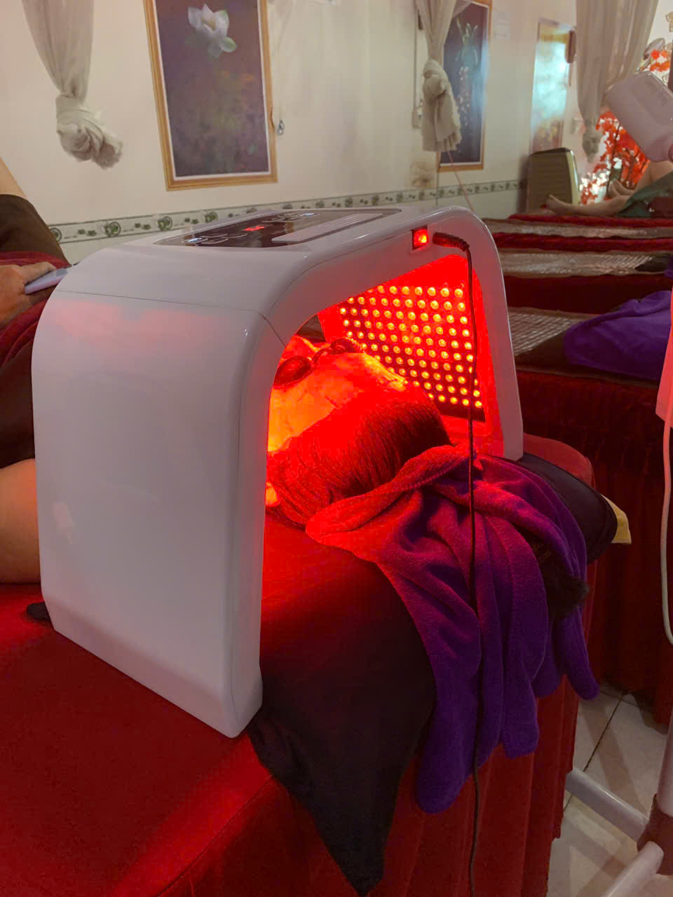 Spa trị mụn nám tại Phan Rang