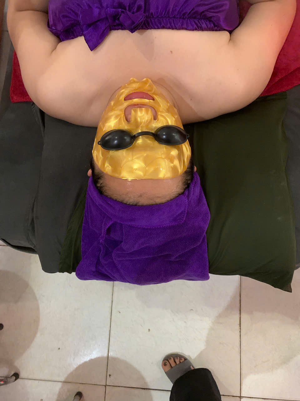 Spa trị mụn nám tại Phan Rang